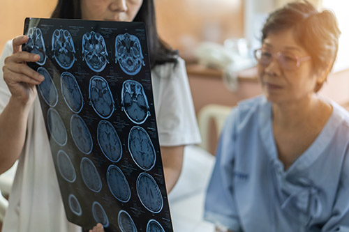 Diagnosing Alzheimer’s Disease - Hiram, GA